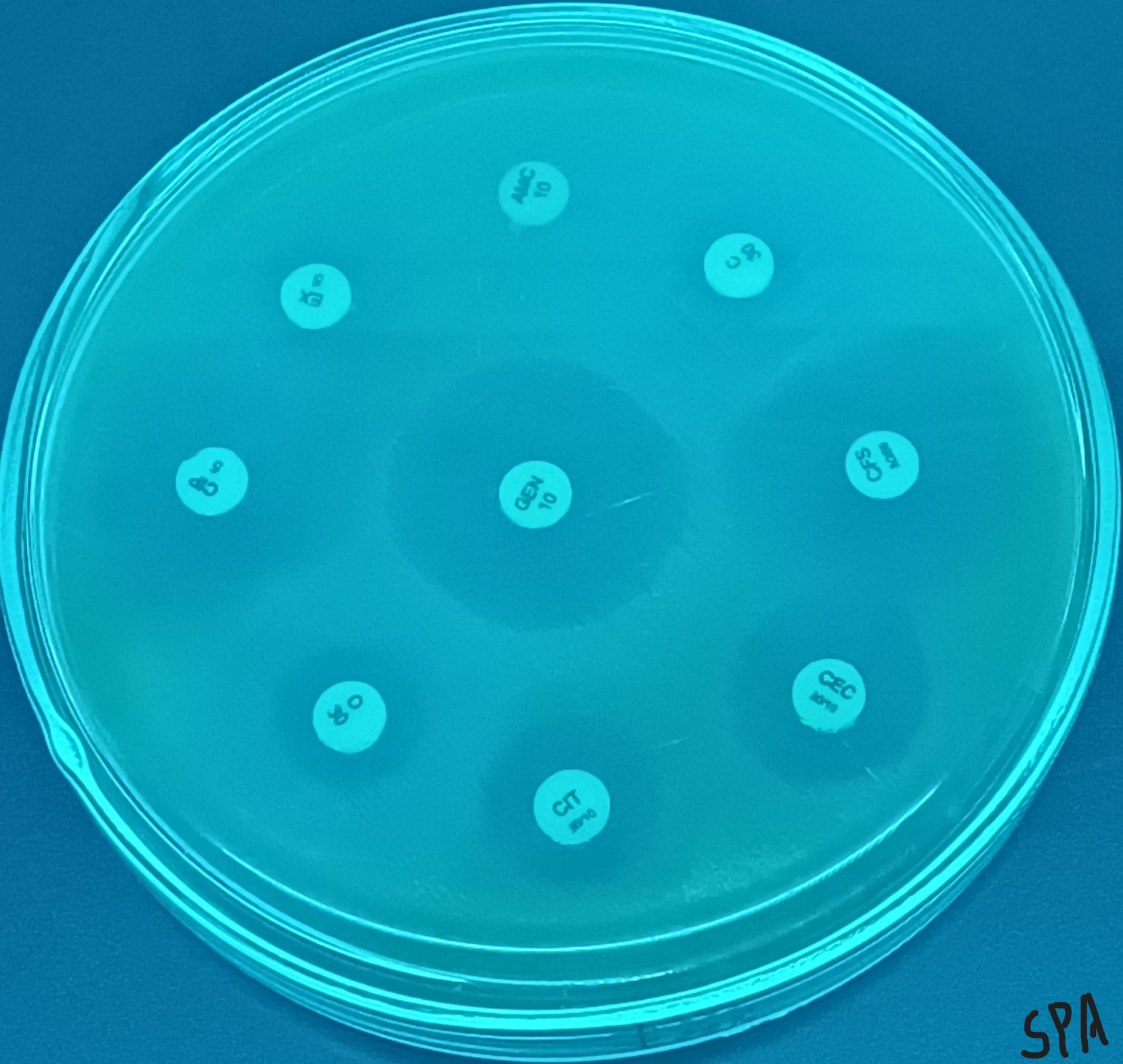 17. Pseudomonas (pyoverdin)